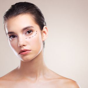 Junge Frau mit Markierungen unter den Augen – Vorbereitung auf eine ästhetische Behandlung gegen Augenringe oder Tränensäcke.