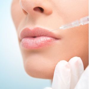 Nahaufnahme einer Lippenunterspritzung mit Hyaluronsäure – ästhetische Behandlung zur Volumensteigerung und Konturverbesserung.